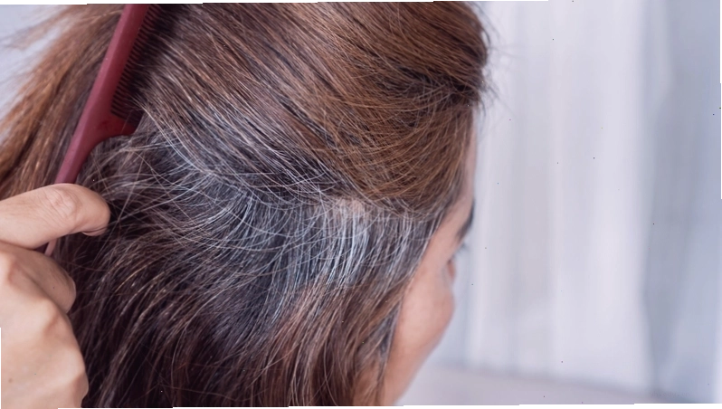 4 vị trí nhiều tóc bạc phản ánh tình trạng sức khỏe trên da đầu