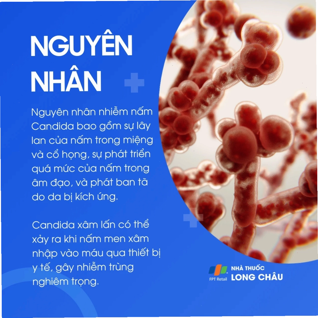 Ảnh giải thích cơ chế lây lan của nấm từ các vị trí nhiễm trùng