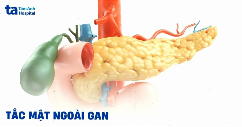 Ảnh hệ thống mật gan
