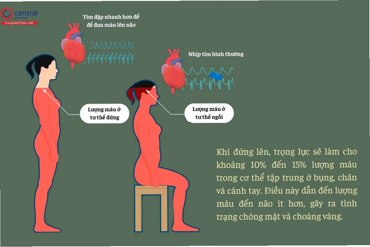 Ảnh hưởng của POTS đến cơ thể