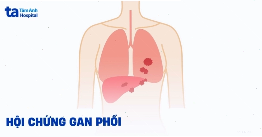 Ảnh liên quan đến cơ chế bệnh lý