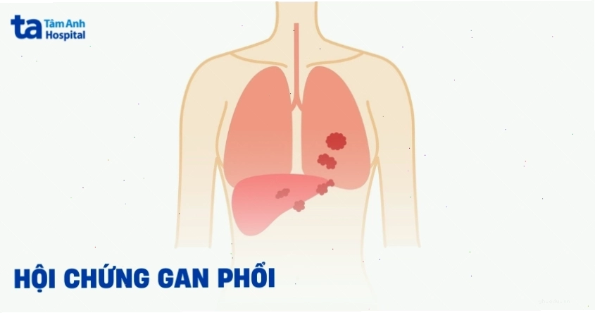 Ảnh minh họa biến chứng tổn thương cơ quan nội tạng
