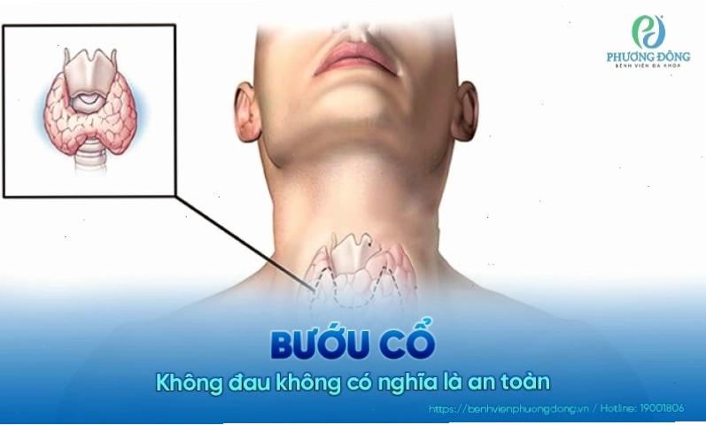 Ảnh minh họa lối sống lành mạnh