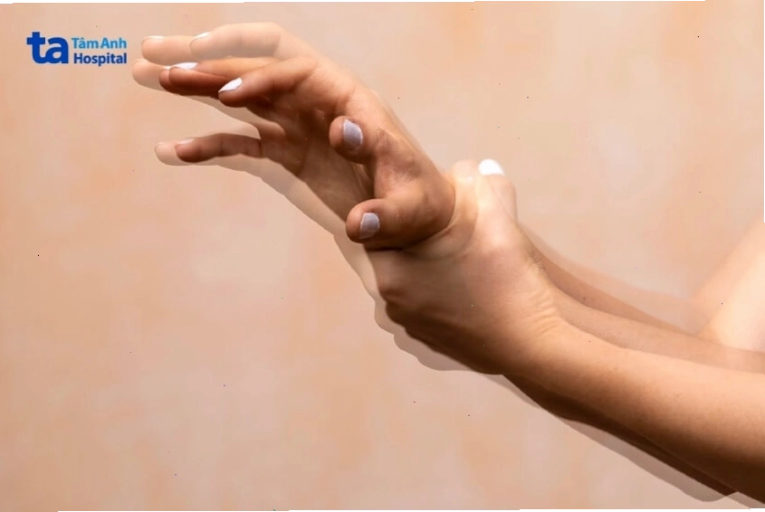 Ảnh minh họa người bệnh đang gặp tình trạng bị run tay khi cầm cốc nước