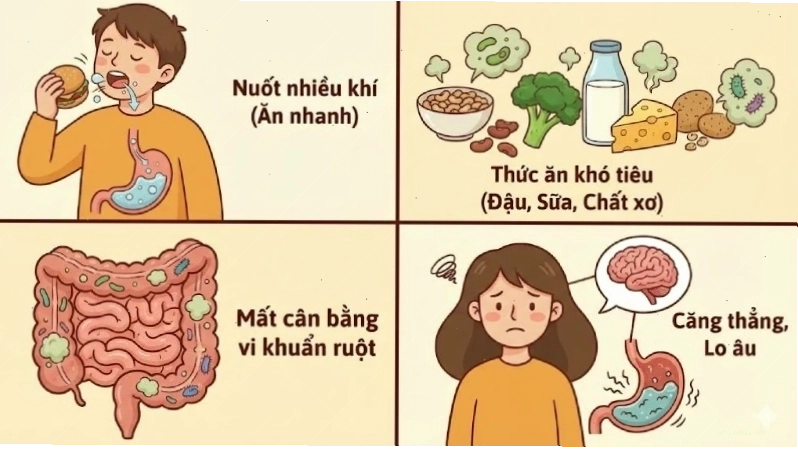 Ảnh minh họa nguyên nhân bụng sôi liên tục