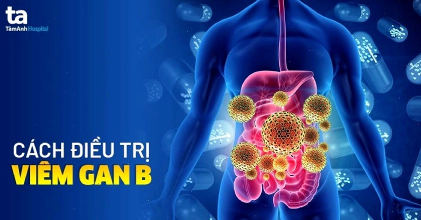 Ảnh minh họa phương pháp điều trị viêm gan B