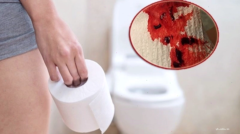 Ảnh minh họa thực phẩm chứa nhiều chất xơ giúp nhuận tràng