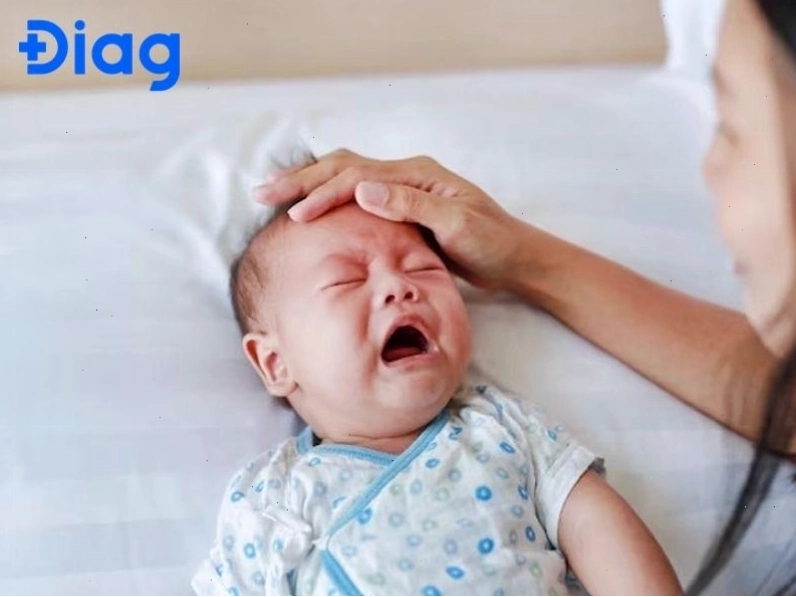 Ảnh minh họa trẻ em gặp khó khăn do ngón tay bị cong