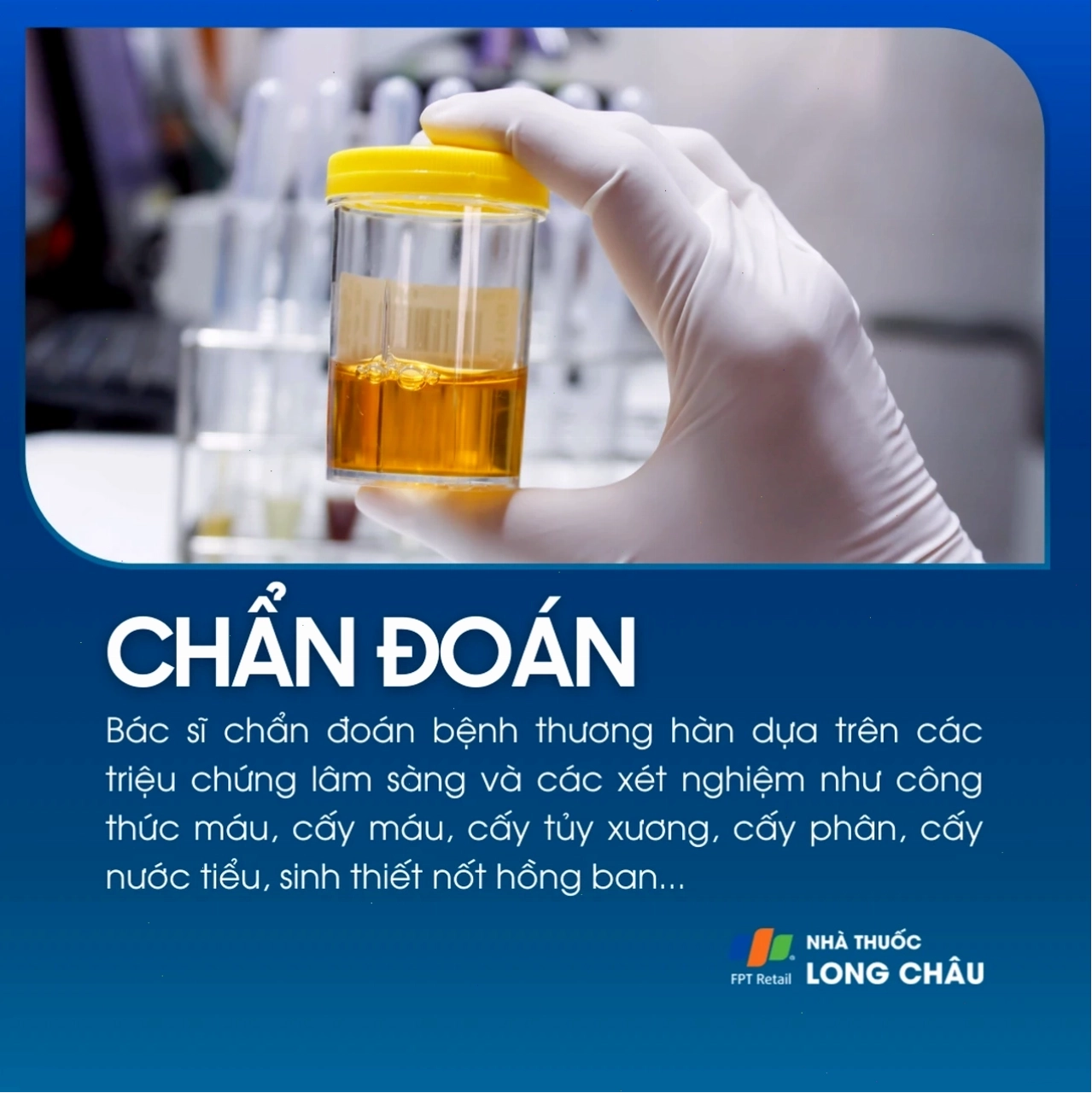 Ảnh minh họa vi khuẩn thương hàn