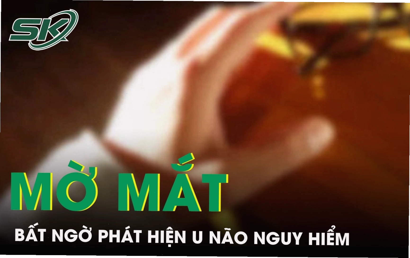 Ảnh mờ mắt
