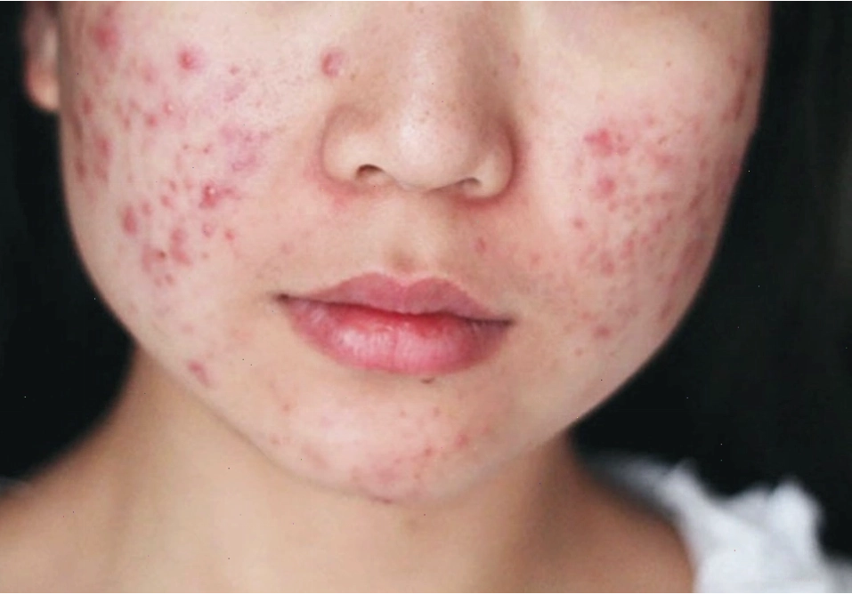 Ảnh mô phỏng cơ thể phản ứng với thức ăn