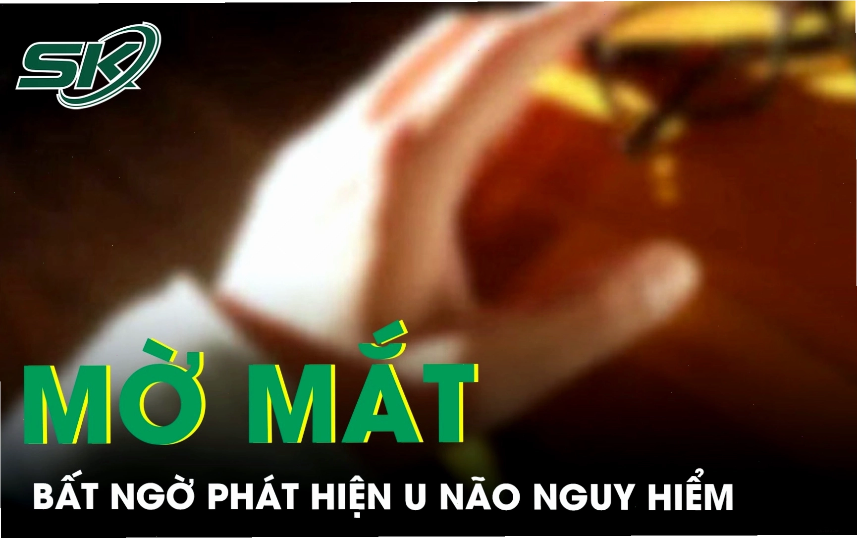 Ảnh mô phỏng dấu hiệu mờ mắt do áp lực nội sọ