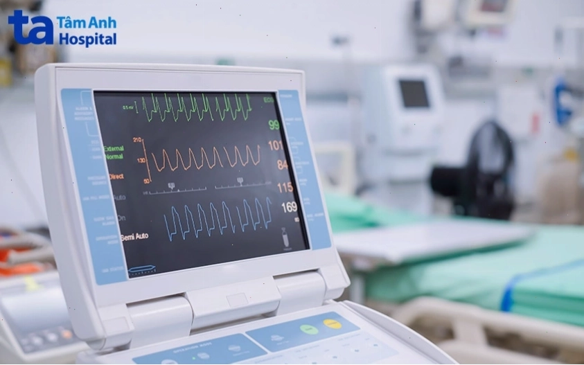 Ảnh mô phỏng kỹ thuật đo điện tâm đồ dùng trong chẩn đoán tim mạch