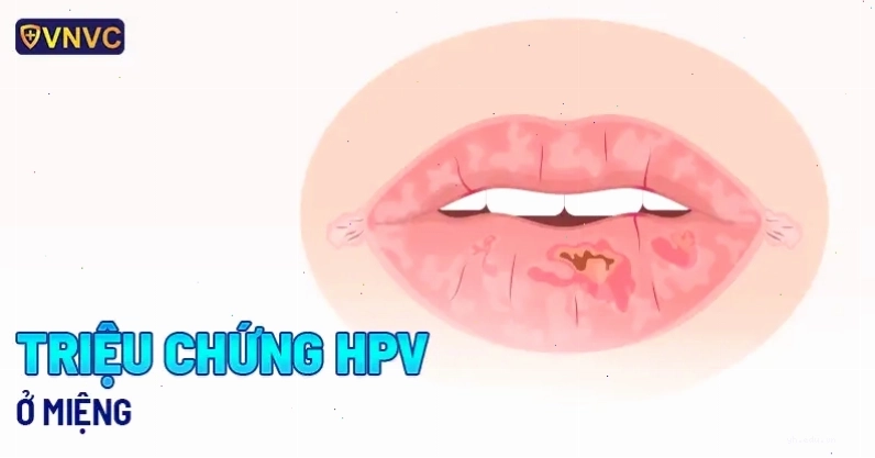 Ảnh mô phỏng nguy cơ nhiễm virus ở vùng miệng