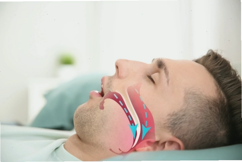 Ảnh mô phỏng tình trạng trào nước bọt khi ngủ