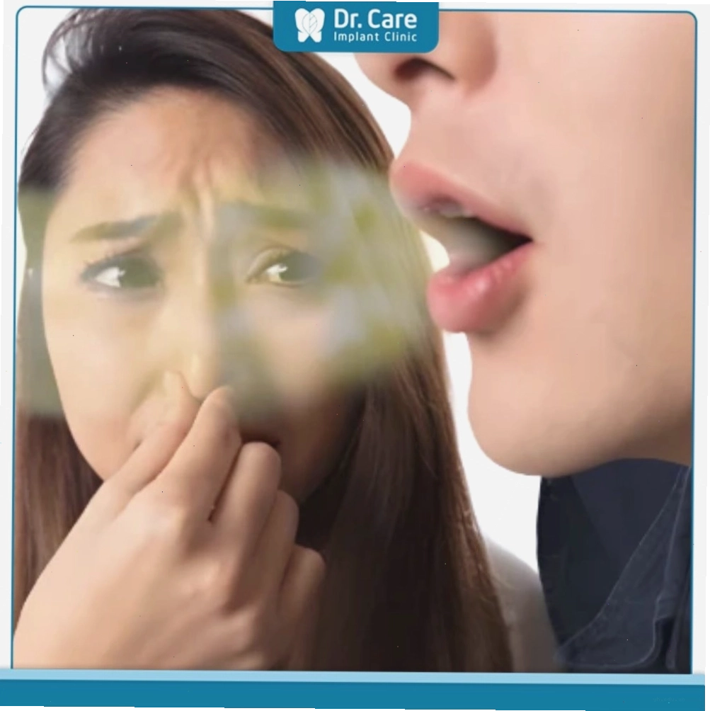 Ảnh mô phỏng triệu chứng hôi miệng