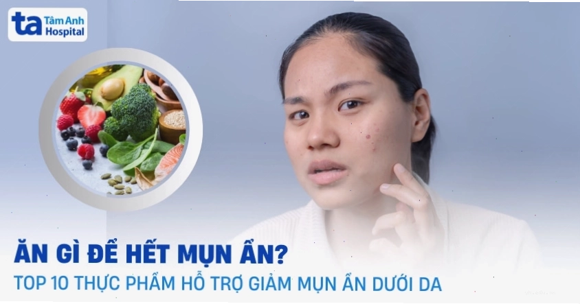 Ảnh thực phẩm tốt cho da mụn