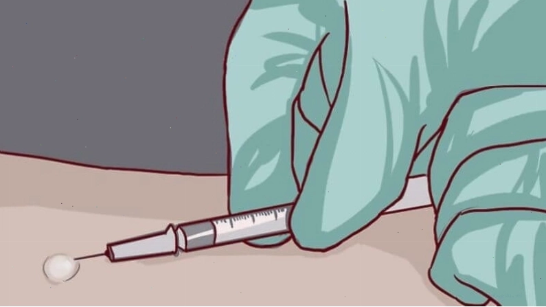 Bác sĩ có thể dựa vào phản ứng Mantoux để chẩn đoán bệnh lao