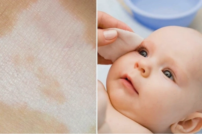 Bác sĩ đang tư vấn về bệnh da liễu