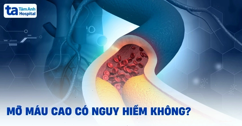 Bác sĩ đang tư vấn về mức độ nguy hiểm của bệnh mỡ máu cao