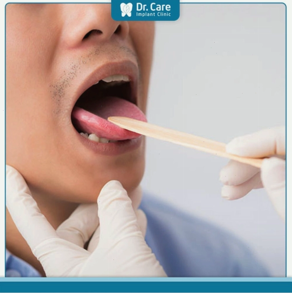Bác sĩ thăm khám lưỡi cho bệnh nhân