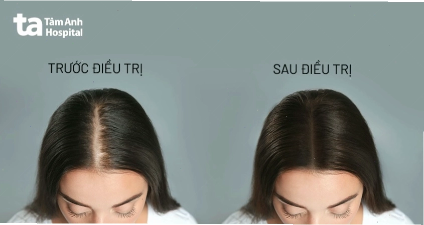 Bác sĩ thăm khám và kiểm tra tình trạng da đầu cho bệnh nhân