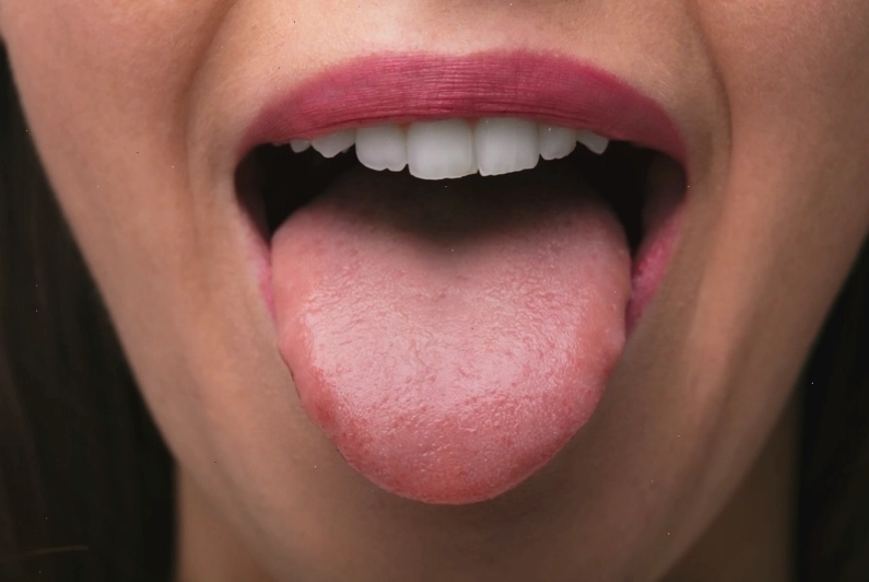 Bác sĩ tư vấn cách điều trị chua miệng