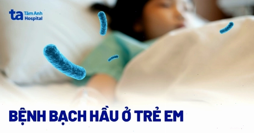 Bạch hầu ở trẻ em và lưu ý cho cha mẹ