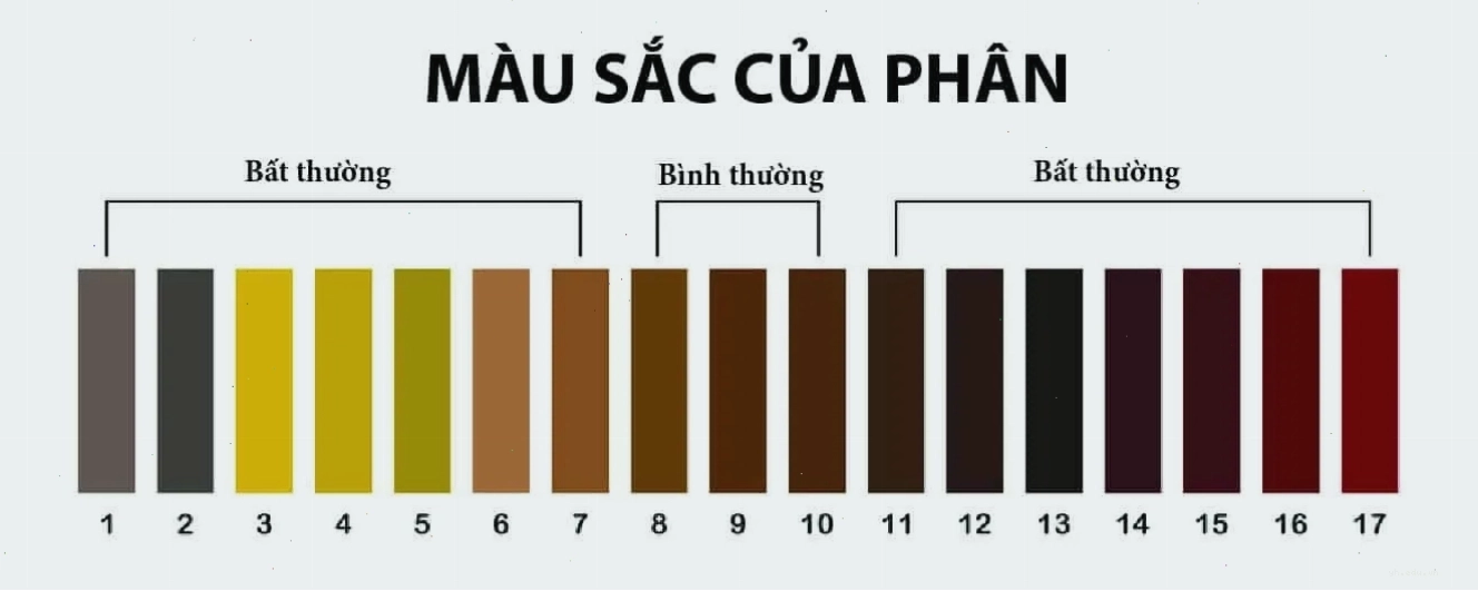 Bảng màu sắc phân giúp nhận diện tình trạng sức khỏe