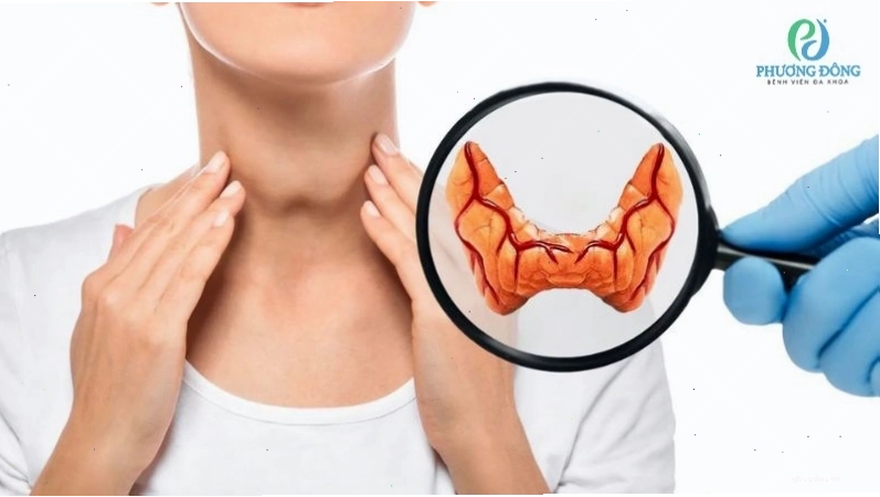 Bệnh cường giáp khiến cơ thể tiêu thụ một lượng nhiệt lớn gây khô miệng