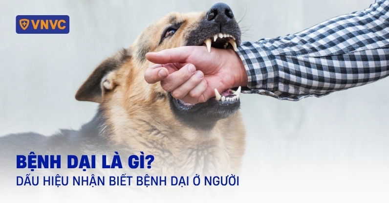 Bệnh dại do virus gì gây ra và cách nhận biết triệu chứng nguy hiểm