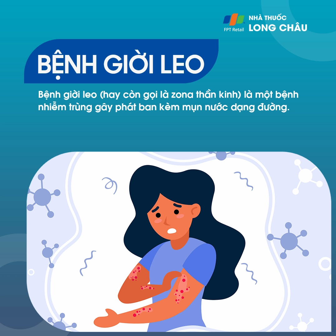 Bệnh giời leo còn gọi là bệnh gì và những điều cần biết để phòng ngừa