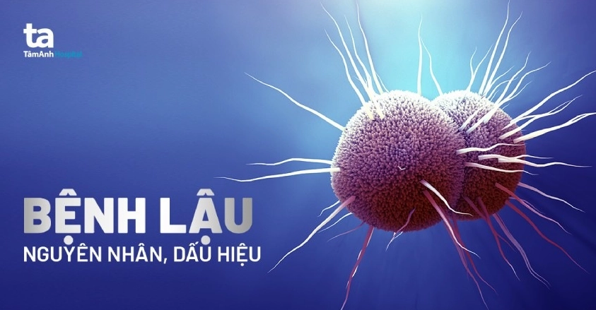 Bệnh lậu do vi khuẩn gì gây ra và những kiến thức y khoa cần biết