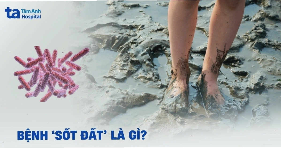 Bệnh sốt đất