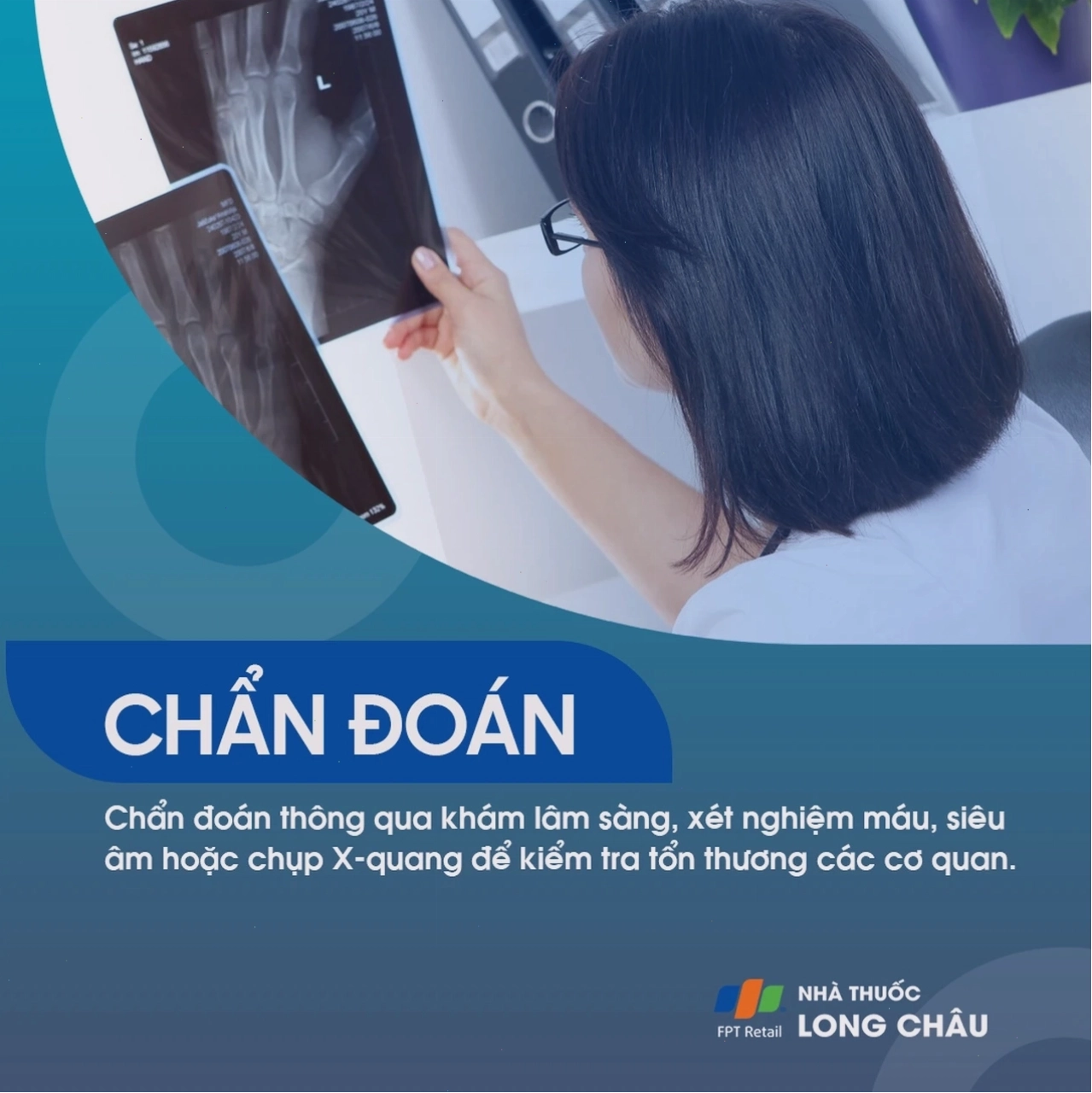 Bệnh Still ở người lớn 5