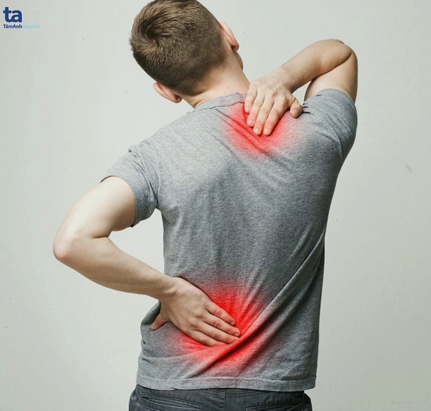 Bệnh viêm cột sống dính khớp
