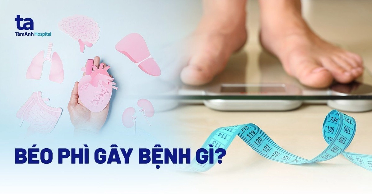 Béo phì bị bệnh gì và những nguy cơ sức khỏe nghiêm trọng cần biết