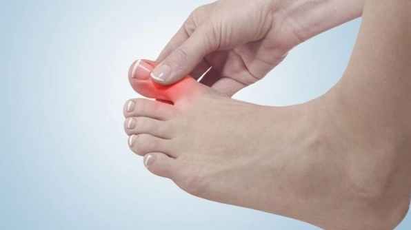 Bị tê ngón chân giữa là bệnh gì và những điều bạn cần cảnh giác