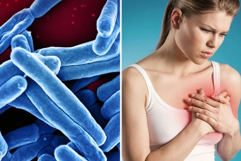 Biến chứng của bệnh lao vú nếu không điều trị