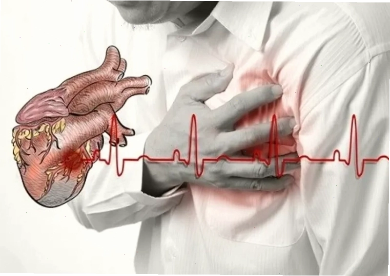 Biến chứng nhồi máu cơ tim nguy hiểm
