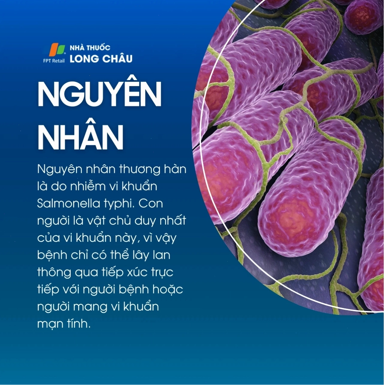 Biến chứng thủng ruột do thương hàn