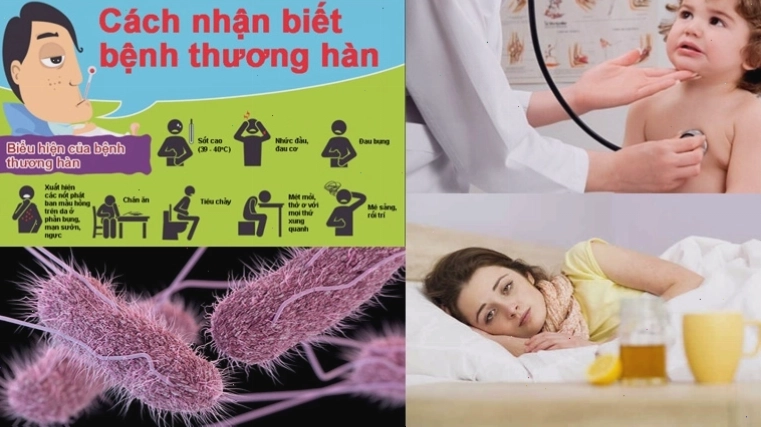 Biểu hiện bệnh thương hàn và phó thương hàn trên cơ thể người