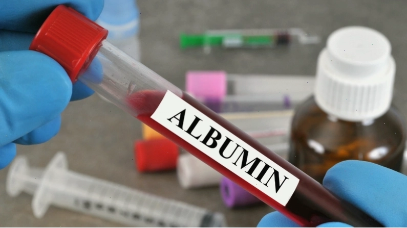 Biểu hiện lâm sàng của triệu chứng phù nề do giảm Albumin