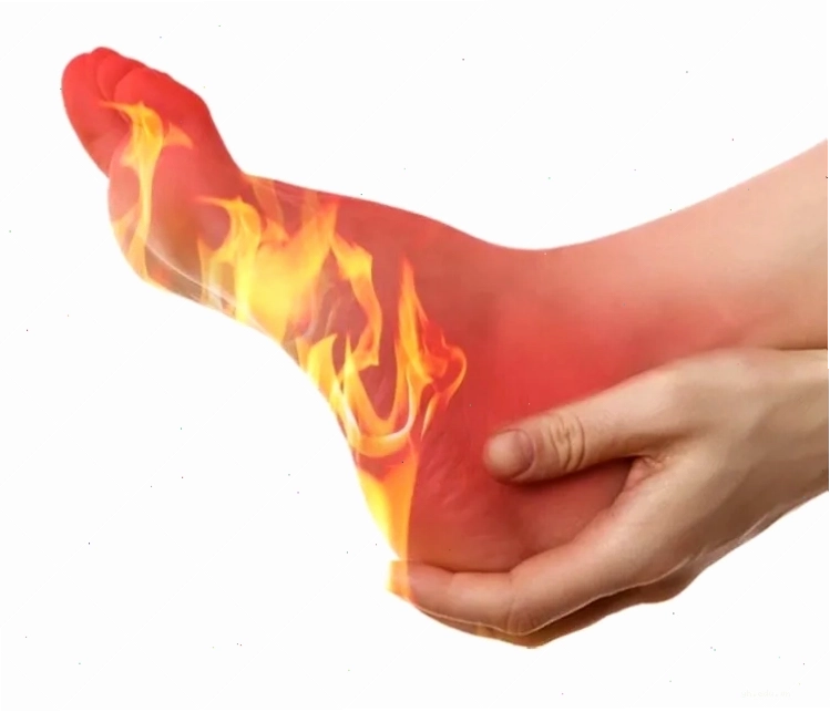 Biểu hiện nóng rát ở bàn chân