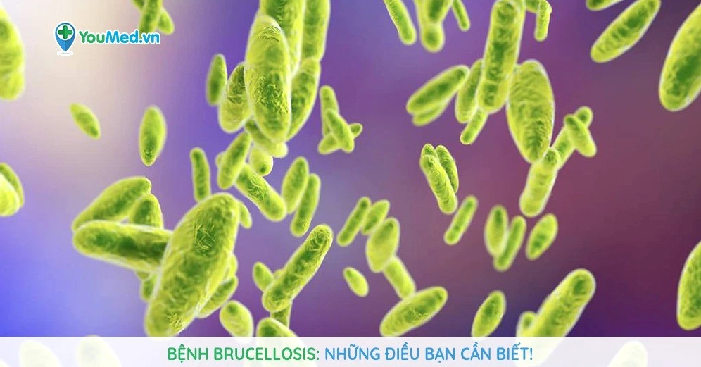 Brucellosis là bệnh gì và những bí ẩn về căn bệnh lây truyền từ động vật