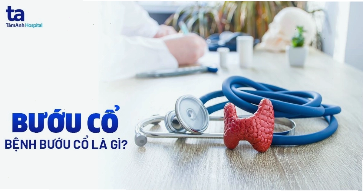 Bướu cổ Nguyên nhân dấu hiệu đối tượng và cách chẩn đoán