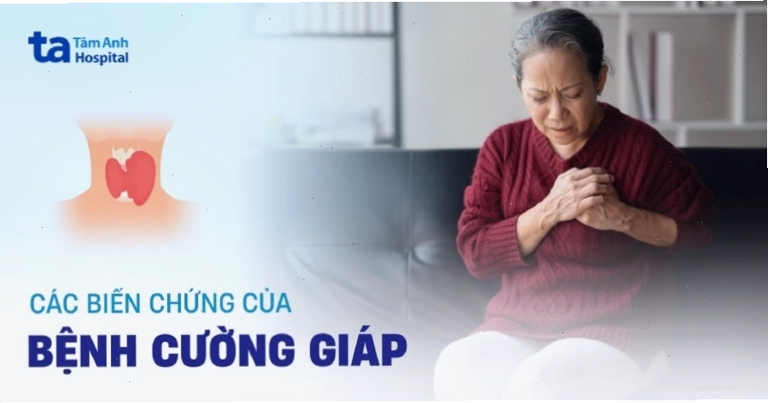Các biến chứng nguy hiểm của bệnh cường giáp