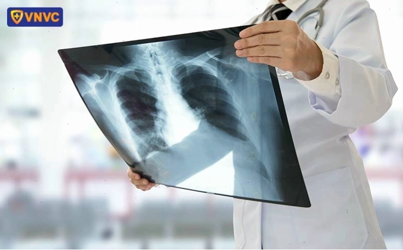 Các biến chứng zona thần kinh cần lưu ý