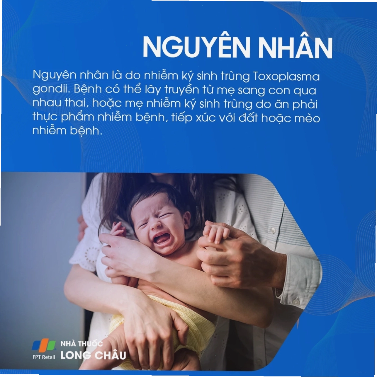 Các bước chăm sóc sức khỏe cho trẻ bị nhiễm Toxoplasmosis bẩm sinh