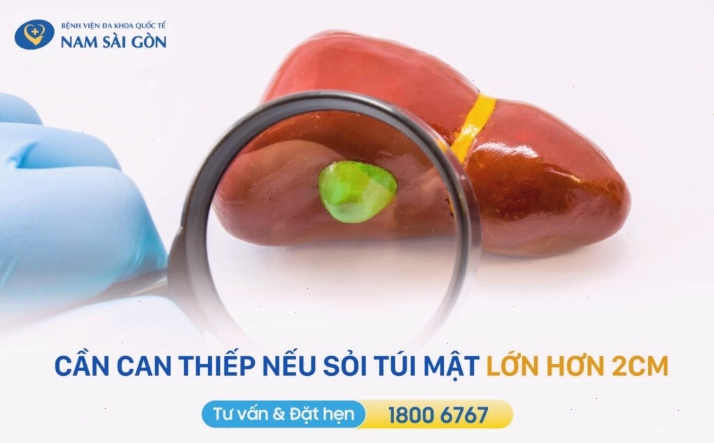 Các bước chuẩn bị trước khi thực hiện cách trị sỏi túi mật